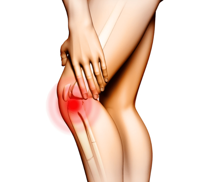 Arthrosis stadiums