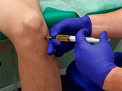 Injection into the knee joint
