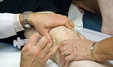 How to distinguish arthritis from osteoarthritis